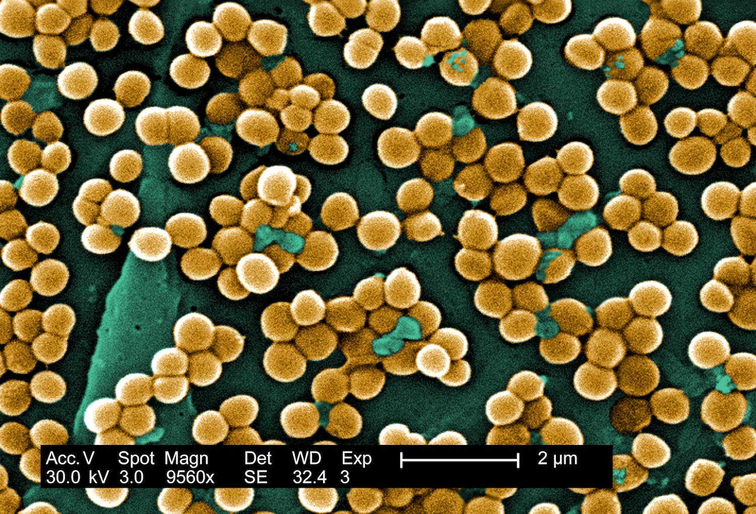 Staphylococcus pseudintermedius. Coloured scanning electron micrograph  (SEM) of Staphylococcus pseudintermedius bacteria. These Gram-positive  cocci (s Stock Photo - Alamy